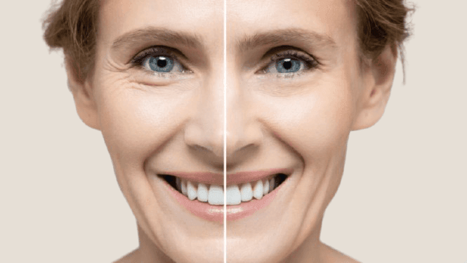 Rotlichttherapie Berlin 